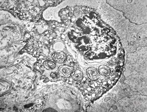 M,3m. | type II. pneumocyte M,3m. | type II. pneumocyte
